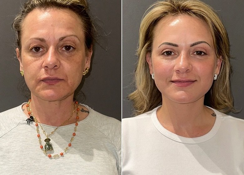 491439737_18323910838207195_5086572488603534422_n