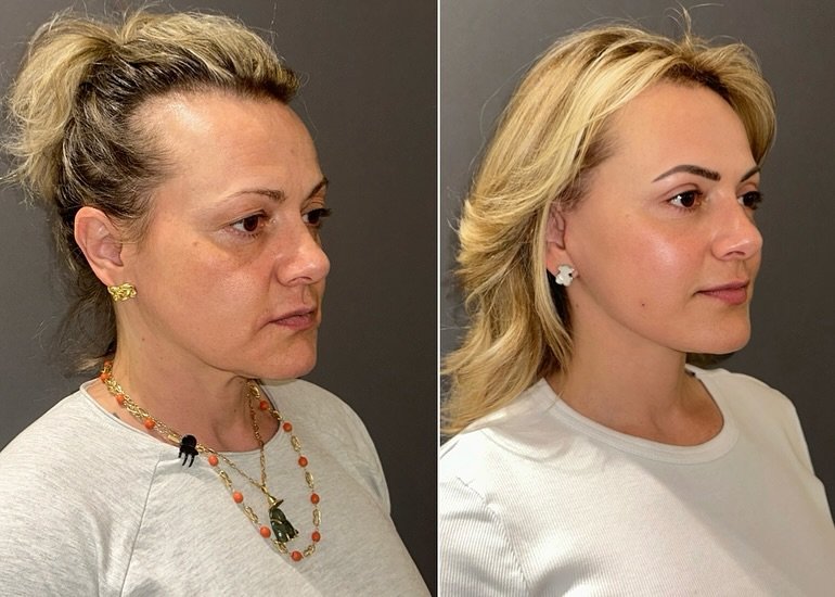 491446237_18323910817207195_1901248687089176943_n