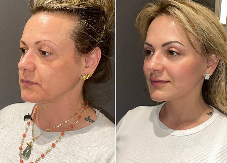 491454304_18323910835207195_5330838610116693393_n