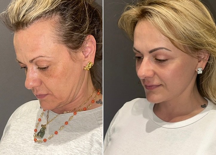 494715365_18323910832207195_3405980843692423081_n